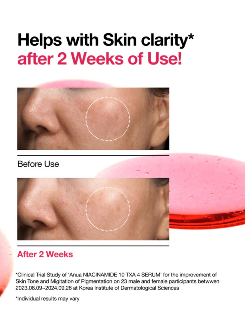 Anua Niacinamide 10% + Txa 4% Serum 30Ml Packaging May Vary 30ml - Image 5