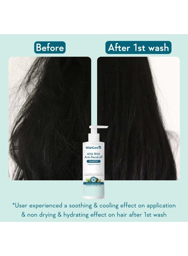 AHA BHA Anti-Dandruff Shampoo | Hydrating Formula - 250ml - Image 4