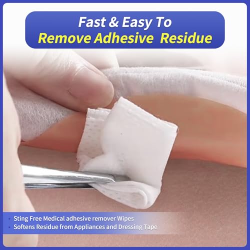 ovand Adhesive Remover Wipes: Adhesive Remover for Skin - No Sting Medical Adhesive Remover, Ostomy Adhesive Remover for Sensitive Skin,Individually Packed (80 pcs) - Image 5