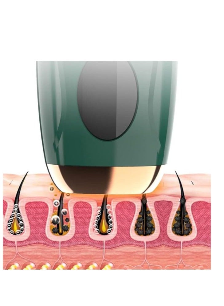 Loquat IPL Hair Removal Device, Permanent Devices, Hair Removal at-Home, 999,999 Flashes Painless Long Lasting for Men and Women, Body, Face, Bikini Zone (Green) - Image 5