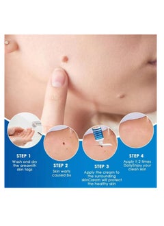 SOL LORA Wart Removal Ointment Cream Skin Treatment With Natural Herbal Ingredients for The Treatment Of Common Warts Effective And Safe  - Image 4
