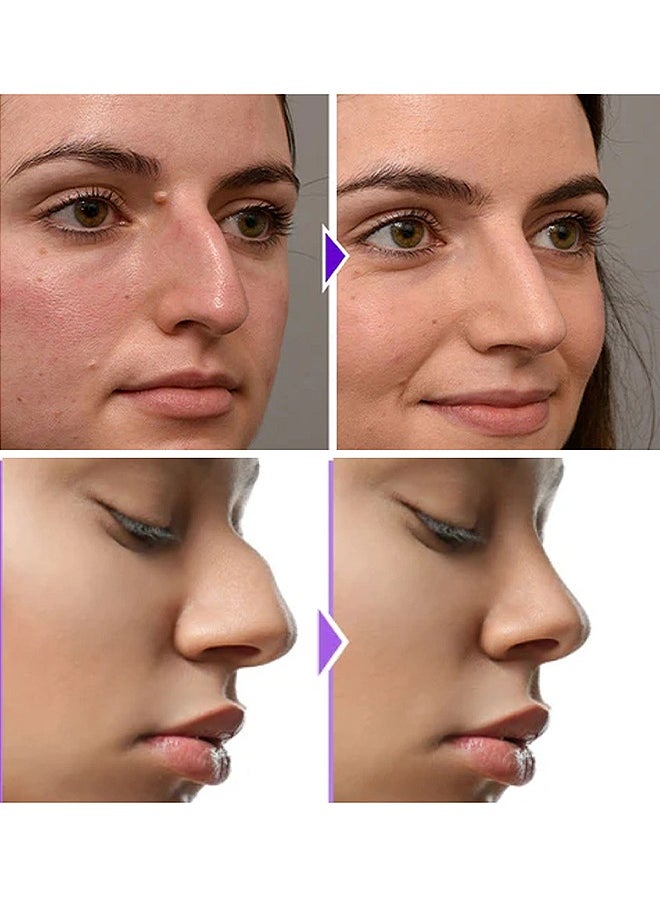EELHOE - Noselift Nose Sculpfing Device, With 10 Minutes Of Daily Use, Takes On Loose Cartilage And Skin On The Nose's Tip, Giving You A Firmer And More Youthful Appearance, Comfortable And User-Friendly - Image 1