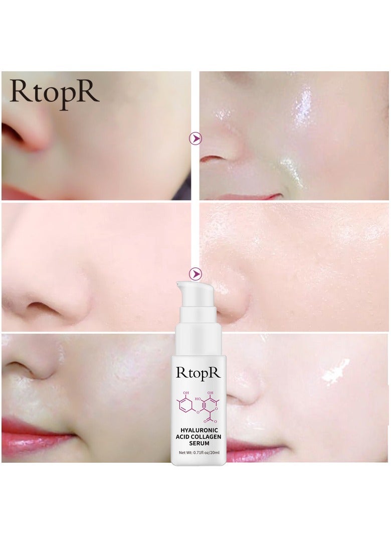 RtopR uric acid collagen stock solution - Image 3