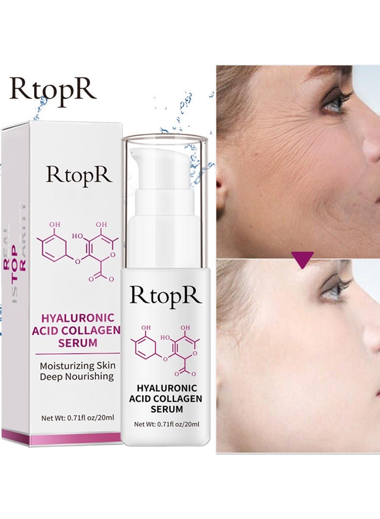 RtopR uric acid collagen stock solution - Image 4