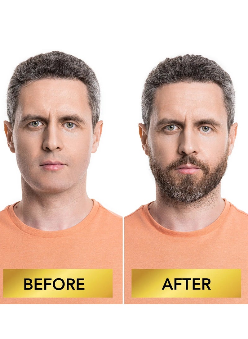 Sefudun 60ml Beard Growth Serum with Microneedle Roller Biotin + 5% Rosemary Beard Growth Oil with 0.25mm Micro Needle Roller Beard Growth Biotin Serum for Thicker Fuller Beard Growth Kit Beard Oil  - Image 3