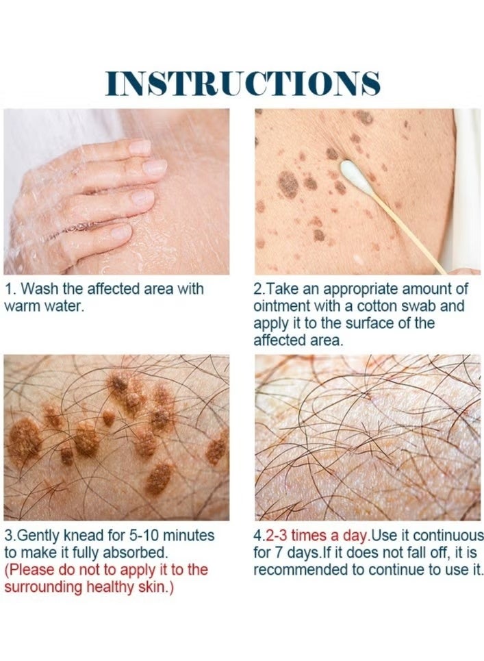 كاني إتش بي كريم مزيل للثآليل – علاج فعال للثآليل الأخمصية والتناسلية ومسامير القدم، 20غ - Image 4