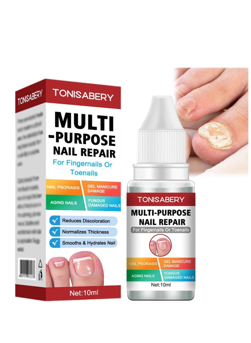 تونيزابري علاج فطر أظافر القدم بقوة إضافية ، حل فعال للأظافر الفطرية والناشبة ، إصلاح الأظافر للتالفة والمكسورة 10 مل - Image 1