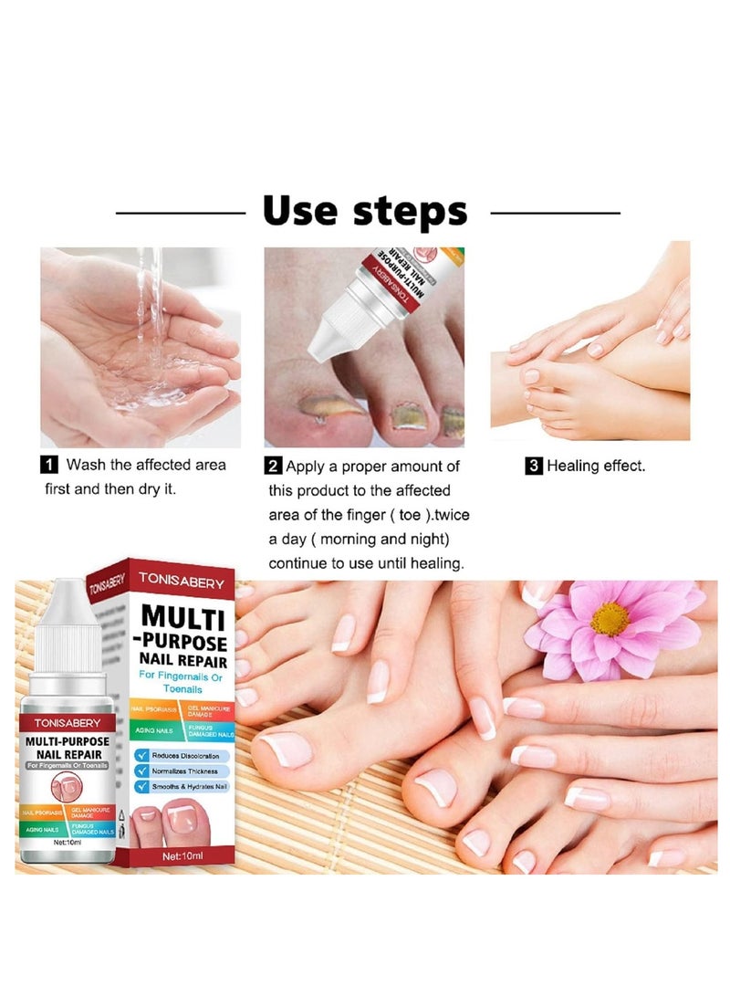 تونيزابري علاج فطر أظافر القدم بقوة إضافية ، حل فعال للأظافر الفطرية والناشبة ، إصلاح الأظافر للتالفة والمكسورة 10 مل - Image 3