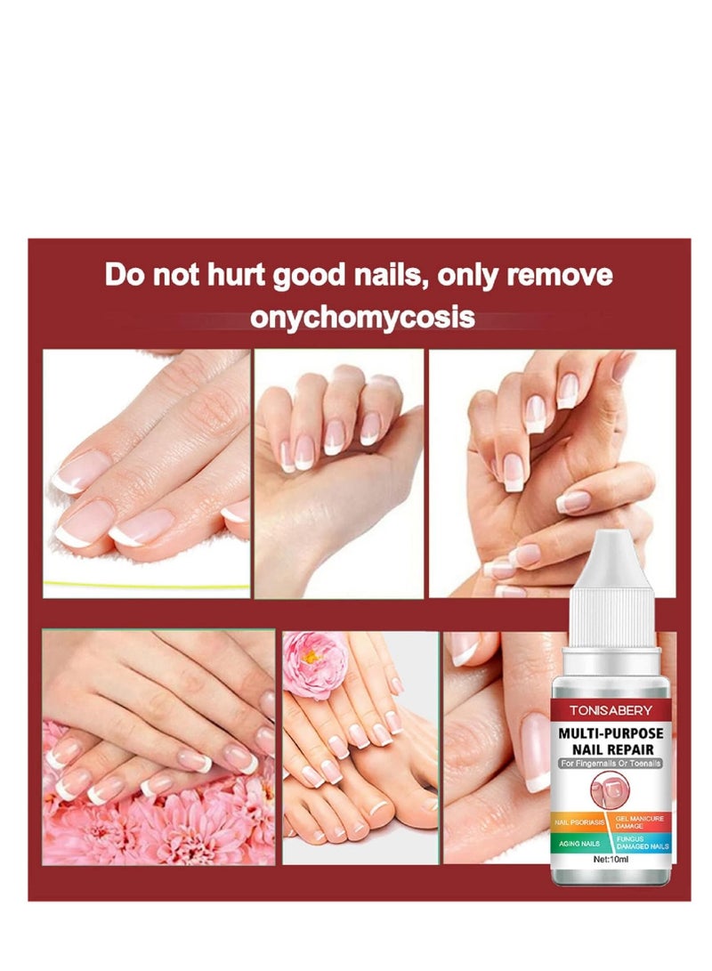 تونيزابري علاج فطر أظافر القدم بقوة إضافية ، حل فعال للأظافر الفطرية والناشبة ، إصلاح الأظافر للتالفة والمكسورة 10 مل - Image 4