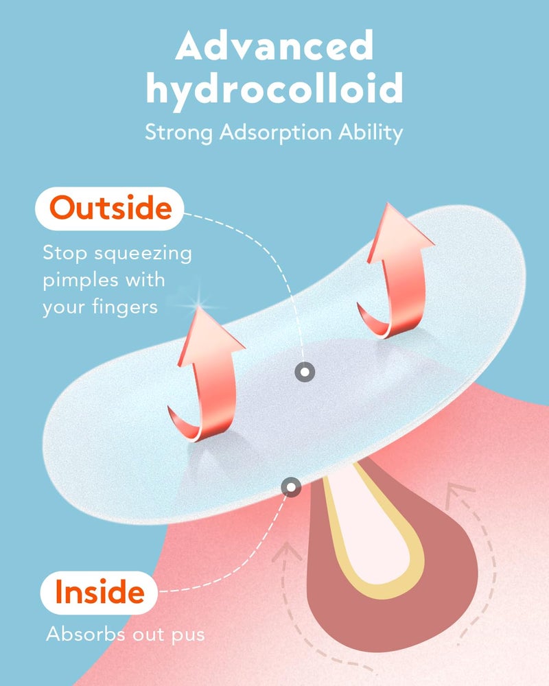 LitBear Large Acne Pimple Patches, 5 Sizes 80 Patches for Large Breakouts, Acne Patches for Face, Chin or Body, Acne Spot Patch with Tea Tree & Calendula Oil, Hydrocolloid Bandages for Acne Skin - Image 5