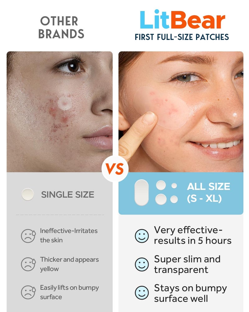 LitBear Large Acne Pimple Patches, 5 Sizes 80 Patches for Large Breakouts, Acne Patches for Face, Chin or Body, Acne Spot Patch with Tea Tree & Calendula Oil, Hydrocolloid Bandages for Acne Skin - Image 3