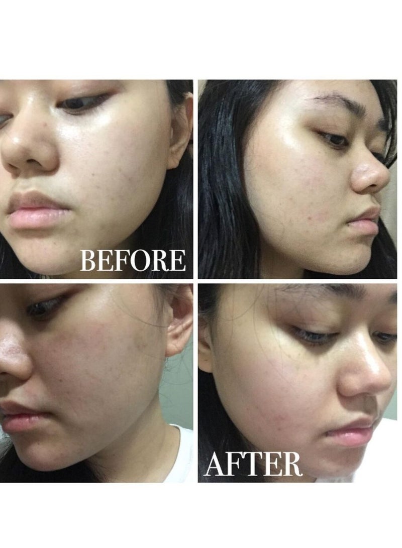 4PM Galactomyces Niacinamide Serum Face Serum for Sensitive Skin Wrinkles, Fine Lines, Uneven Skin Korean Skincare - Image 5