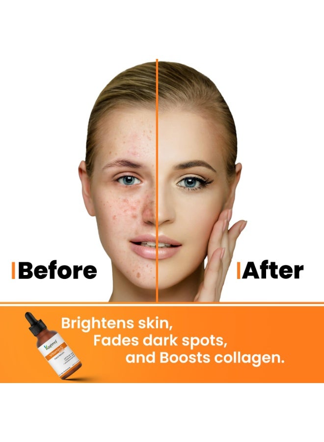 KAZIMA 10% Vitamin C Face Serum for Glowing Skin with 0.5% Ferulic Acid | Targets Dark Spot & Hyperpigmentation | For Dull Skin | Vitamin C Serum for Oily Skin | Suitable for Men & Women | 30 ml - Image 2