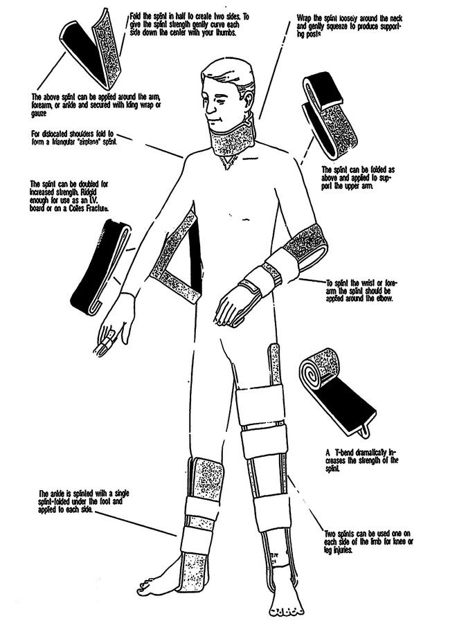 BELTWALA Lightweight Combat Splint (36 Inch) (Red)| Moldable Waterproof First Aid Medical Splint | Tactical Reusable Field Splint for Bone Fracture Treatment | Emergency Limb Immobilizer - Image 5