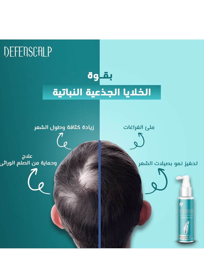 Defenscalp Hair Lotion - Restores Hair Growth - Stimulates Follicles and Fills Gaps - Packaging May Vary - Image 3