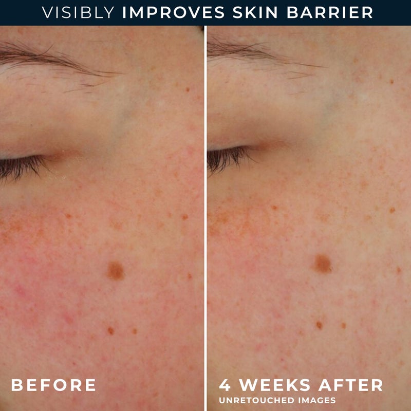 RoC Barrier Renew Day Cream with SPF 30, Moisturizer with Ceramides & Prebiotics to Protect Skin Barrier, (2.5 oz) with Retinol Eye Cream Packette - Image 5