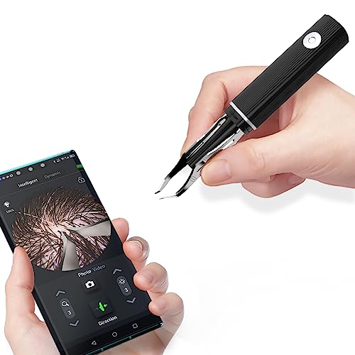 scopepick ملقط إزالة الشعر مع كاميرا 1080p، دقة قصوى: ملقط مع كاميرا - مثالي للمهام الدقيقة! - ملقط شعر الأذن والحواجب - Image 1