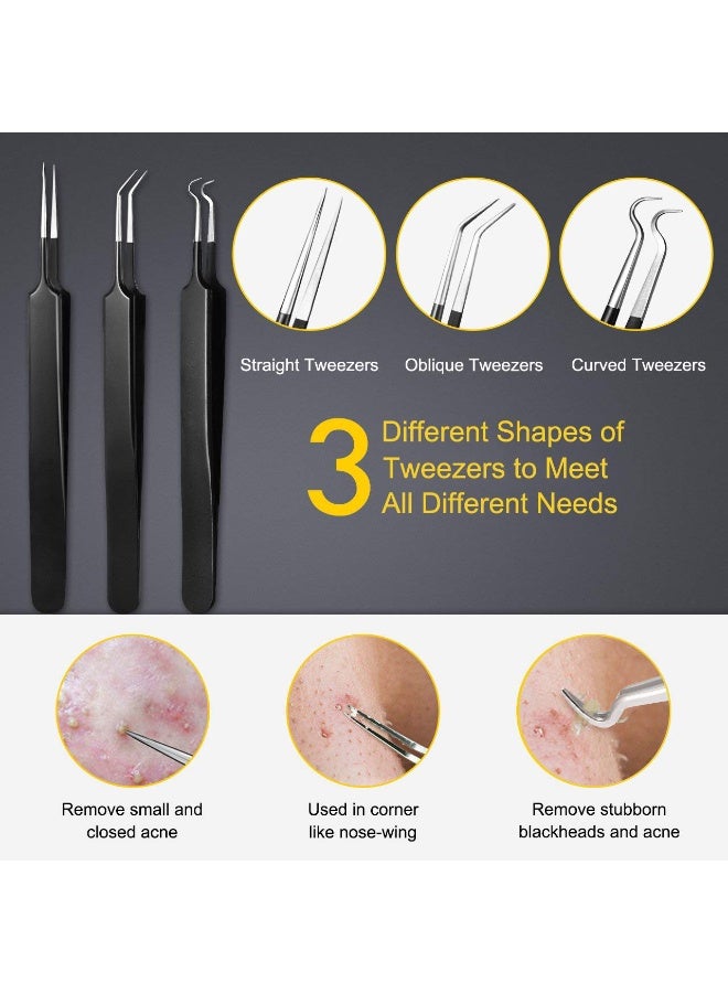 Dark Horse 10-Piece Blackhead Removal Kit Set, With Box, Can Quickly And Easily Remove Pimples, Blackheads, Acne, Forehead, Face And Nose - Image 4