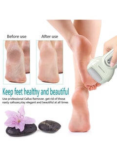 EELHOE Rechargeable Electric Foot Callus Remover Machine 3 in 1 Grinding Pedicure Tools Foot Care Tool Dead Hard Skin Callus Remover  - Image 4