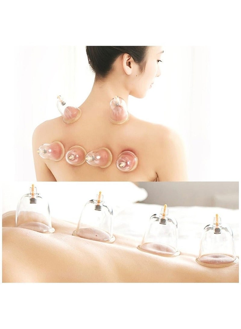 24-Cup Professional Chinese Acupuncture Points Cupping Therapy Set with Vacuum Magnetic Pump - Image 3