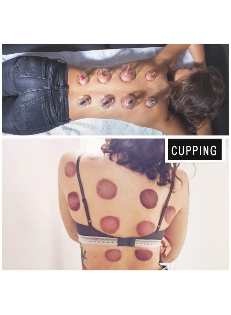 24-Cup Professional Chinese Acupuncture Points Cupping Therapy Set with Vacuum Magnetic Pump - Image 5