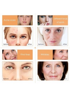 MOOYAM Vitamin C Face Serum - Anti-Aging Whitening Serum, Dark Spot Corrector, Fine Lines and Wrinkles with Hyaluronic Acid，Vitamin E - Anti-Wrinkle,Dark Circles, Age Spots, Pore Cleanser, Acne Scars  - Image 2