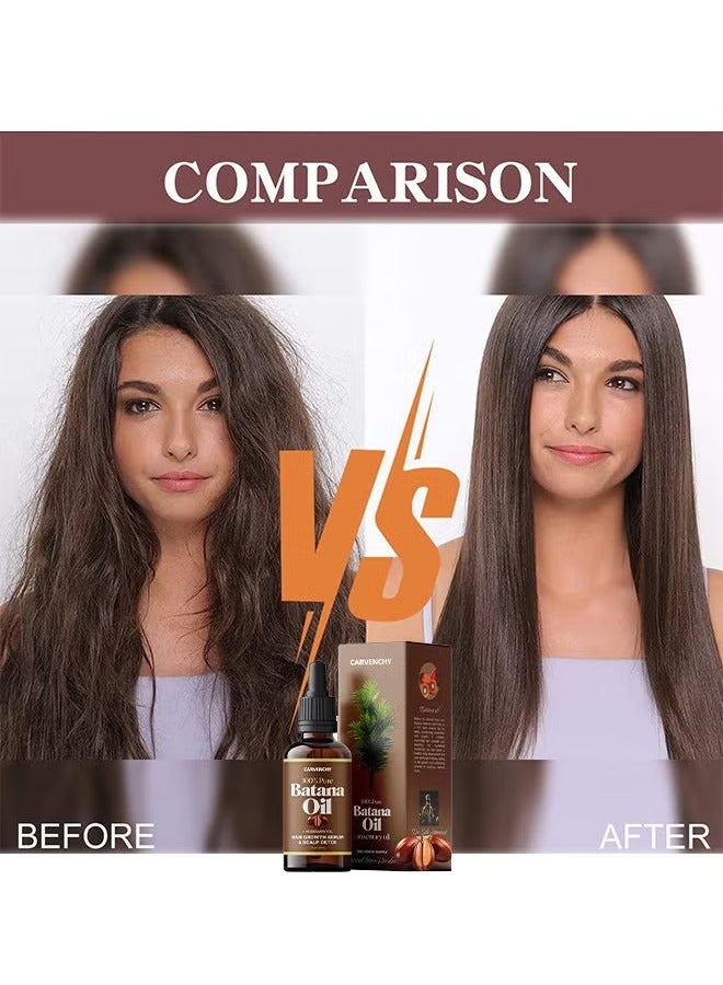 CARVENCHY Batana Oil Rosemary Oil Hair Growth Serum - Nourish Scalp & Detox for Strong & Healthy Hair 100% Organic Batana Oil from Honduras with Rosemary - Reduce Hair Loss & Detox Your Scalp 30ml - Image 3