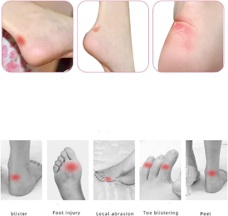 JSHshield Blister PadsGel Blister Cushions Treatment PatchHydrocolloid Seal Adhesive Blister Bandages for FingersToesForefootHeel Prevent blistersWaterproof 15PCS - Image 3