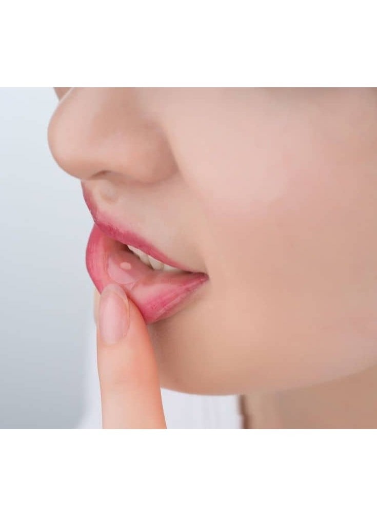 Curatick Oral Wound Home Care Solution Tick On 12mm  - Image 3