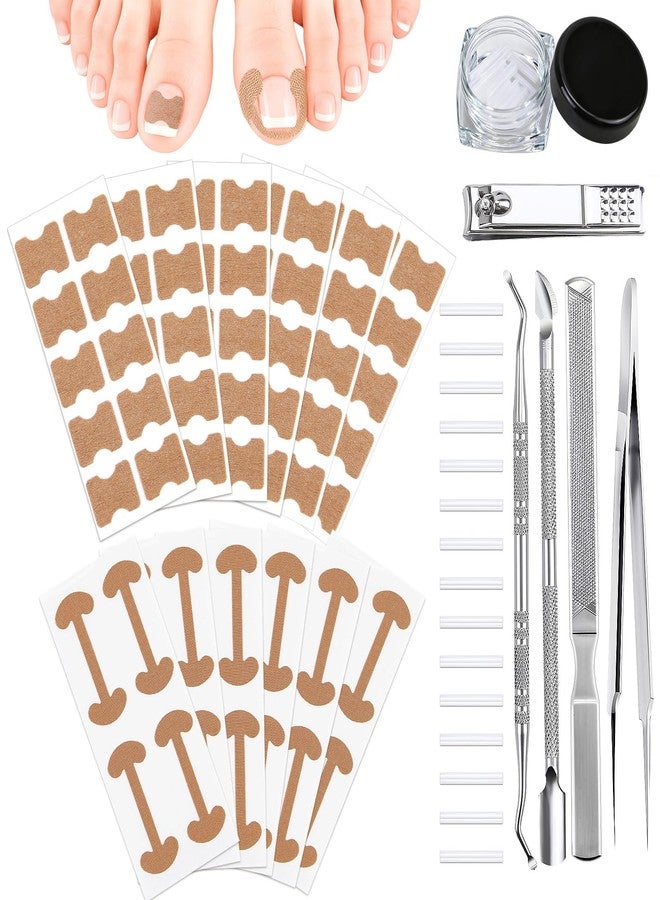 GETRIC Ingrown Toenail Corrector Set with Correction Strips, Professional Ingrown Toenail Removal Kit, Painless File and Lifter Pedicure Tool Curved Toenails Corrector Patch for men and women - Image 1