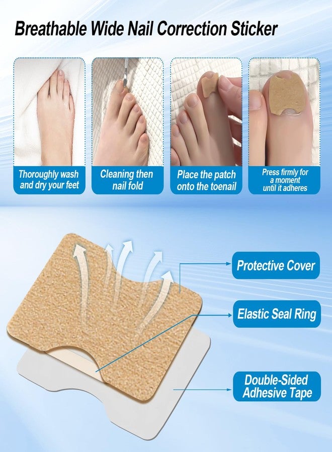 GETRIC Ingrown Toenail Corrector Set with Correction Strips, Professional Ingrown Toenail Removal Kit, Painless File and Lifter Pedicure Tool Curved Toenails Corrector Patch for men and women - Image 4