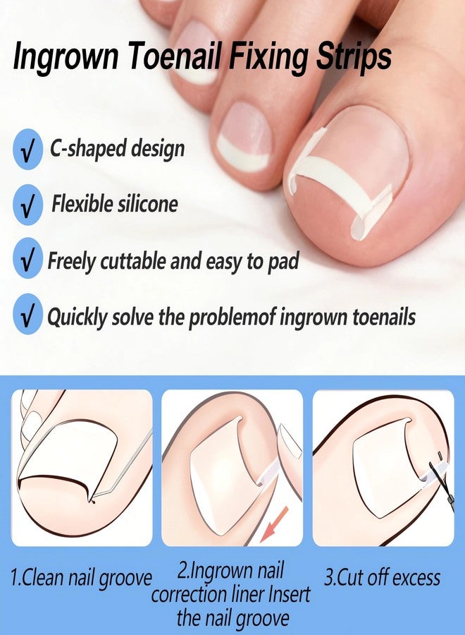GETRIC Ingrown Toenail Corrector Set with Correction Strips, Professional Ingrown Toenail Removal Kit, Painless File and Lifter Pedicure Tool Curved Toenails Corrector Patch for men and women - Image 5
