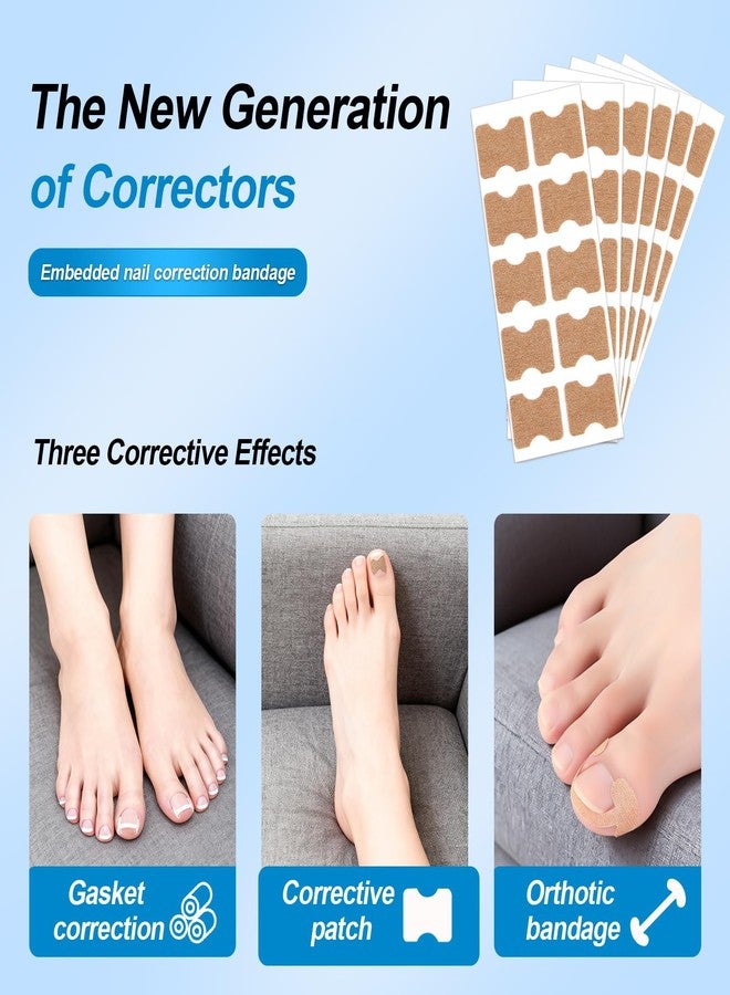 GETRIC Ingrown Toenail Corrector Set with Correction Strips, Professional Ingrown Toenail Removal Kit, Painless File and Lifter Pedicure Tool Curved Toenails Corrector Patch for men and women - Image 3