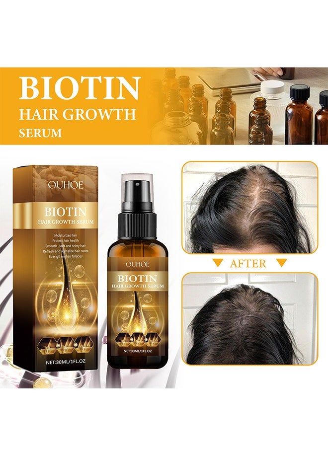 OUHOE Biotin Hair Serum, Hair Regrowth Spray, Biotin Thickening Herbal Serum, Anti Hair Loss Serum For Hair Growth And Hair Loss, Hair Regrowth For Thicker Longer Fuller Hai 30ml  - Image 4