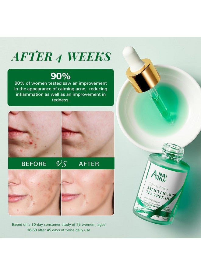ANAI RUI Acne Face Oil,Tea Tree Oil With Salicylic Acid,Acne Prone Skin Oil,Soothe Acne,Redness Relief, Tea Tree Oil For Face,Back, Clarifying & Purifying 1Fl.Oz - Image 4