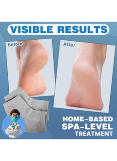 TEAWOO TEAWOO 6 Pairs Moisturizing Heel Socks for Cracked Heel Treatment, Foot Care Toeless Socks to Soften and Hydrate Dry Cracked Feet Heels, Cracked Heel Repair Socks, Gel Socks for Dry Cracked Feet  - Image 2