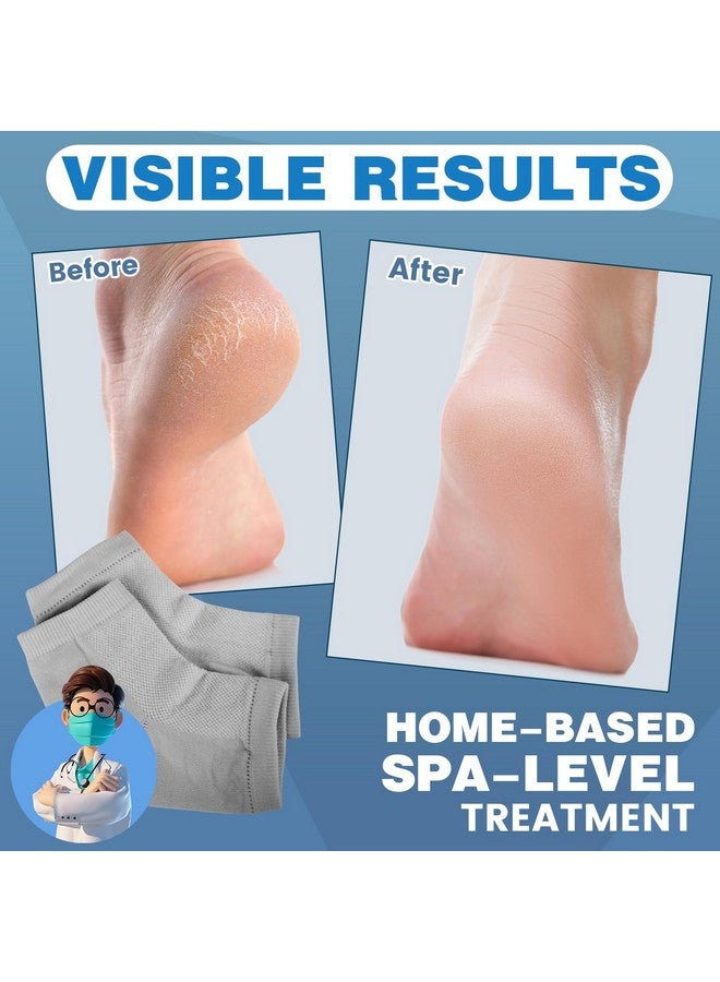 TEAWOO TEAWOO 6 Pairs Moisturizing Heel Socks for Cracked Heel Treatment, Foot Care Toeless Socks to Soften and Hydrate Dry Cracked Feet Heels, Cracked Heel Repair Socks, Gel Socks for Dry Cracked Feet - Image 2