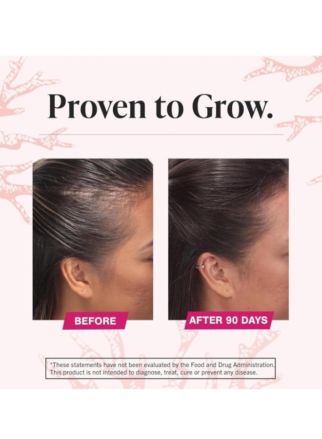 فيفيسكال، مكملات غذائية متقدمة لصحة الشعر للنساء، عبوة تكفي لثلاثة أشهر، ١٨٠ قرصًا - Image 4