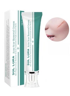SOL LORA Acne Scar Removal Cream，Scar Erase ，Scar Removal Gel，Acne Scar Treatment，Deep Acne Scar Removal， Burns Keloids Hypertrophic， Repair Damaged Skin，Removing Acne Marks Scar Repair Cream ﻿  - Image 2