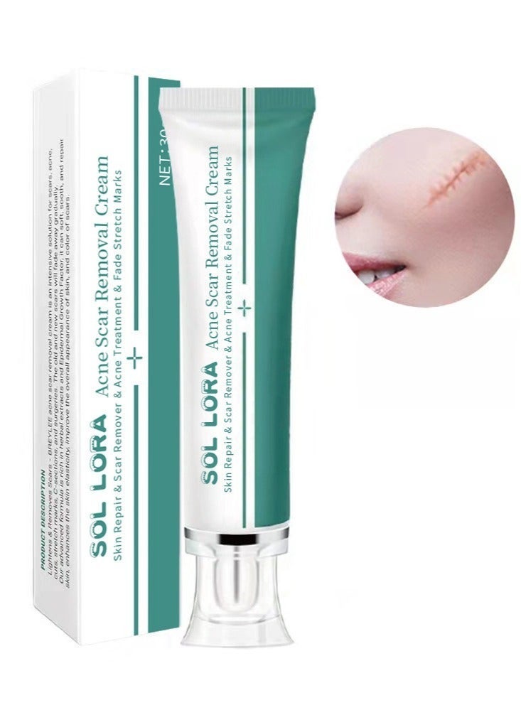 SOL LORA Acne Scar Removal Cream，Scar Erase ，Scar Removal Gel，Acne Scar Treatment，Deep Acne Scar Removal， Burns Keloids Hypertrophic， Repair Damaged Skin，Removing Acne Marks Scar Repair Cream ﻿ - Image 2