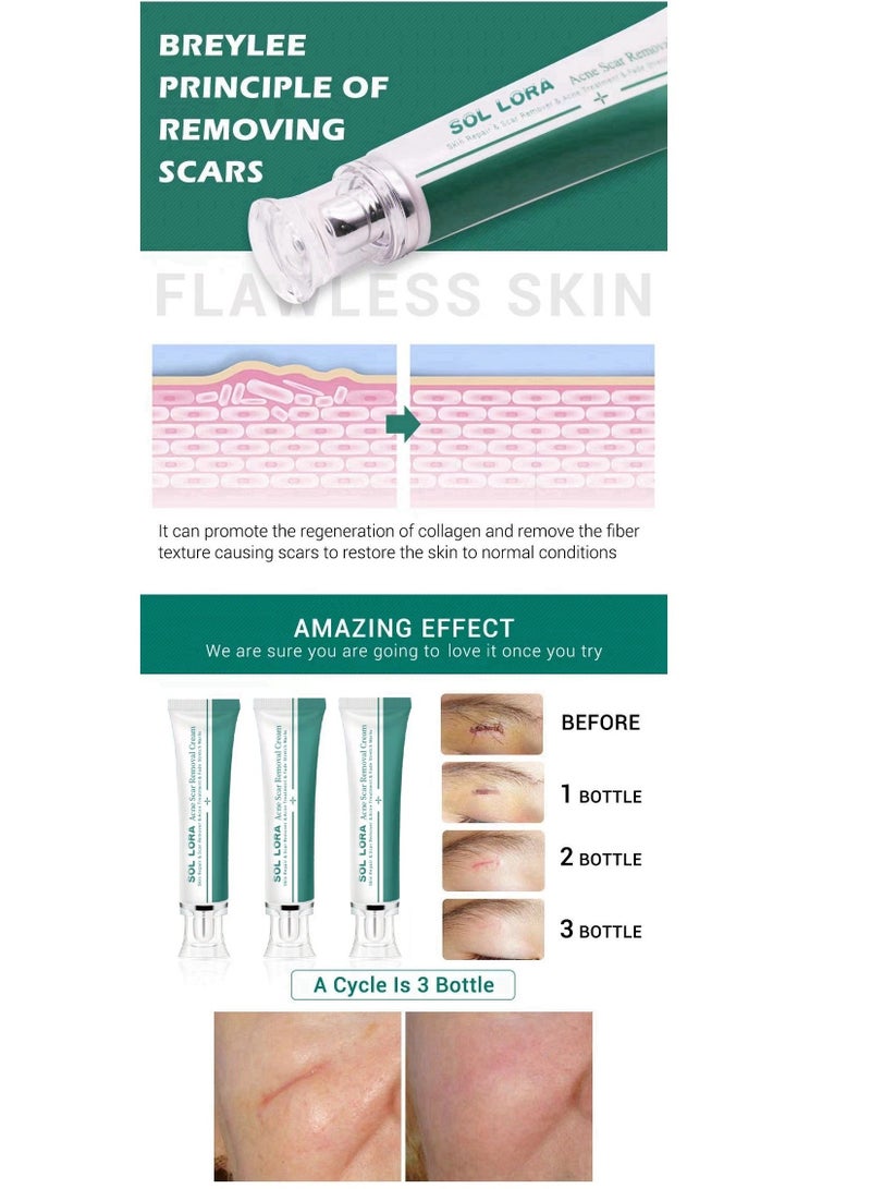 SOL LORA Acne Scar Removal Cream，Scar Erase ，Scar Removal Gel，Acne Scar Treatment，Deep Acne Scar Removal， Burns Keloids Hypertrophic， Repair Damaged Skin，Removing Acne Marks Scar Repair Cream ﻿ - Image 4