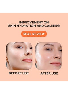 Epielle Epielle Serum Sheet Masks (5pk) | Korean Skincare | Facial Sheet Mask | Kbeauty (Vitamin C Serum Sheet Mask -5pk)  - Image 2