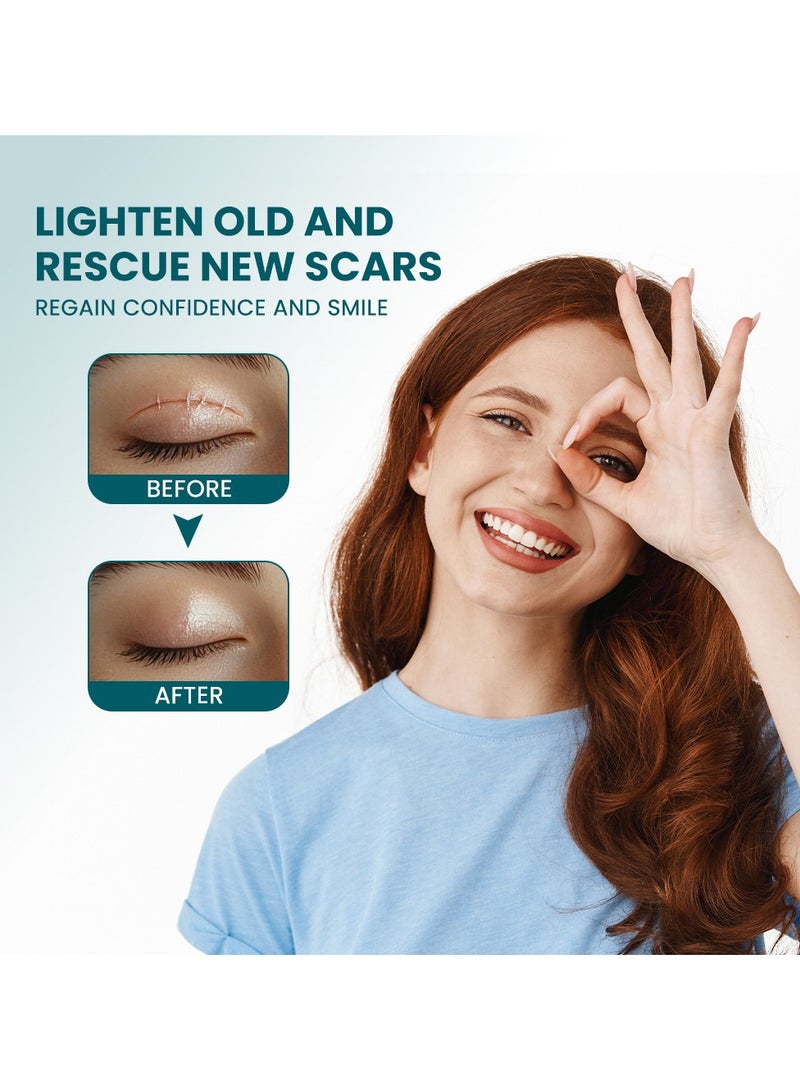 سوميفون رقعة إصلاح الجروح والندبات، رقعة إزالة الندبات الجراحية، رقعة العناية بندبات الصدمات الرياضية (2 × 100 سم) - Image 4