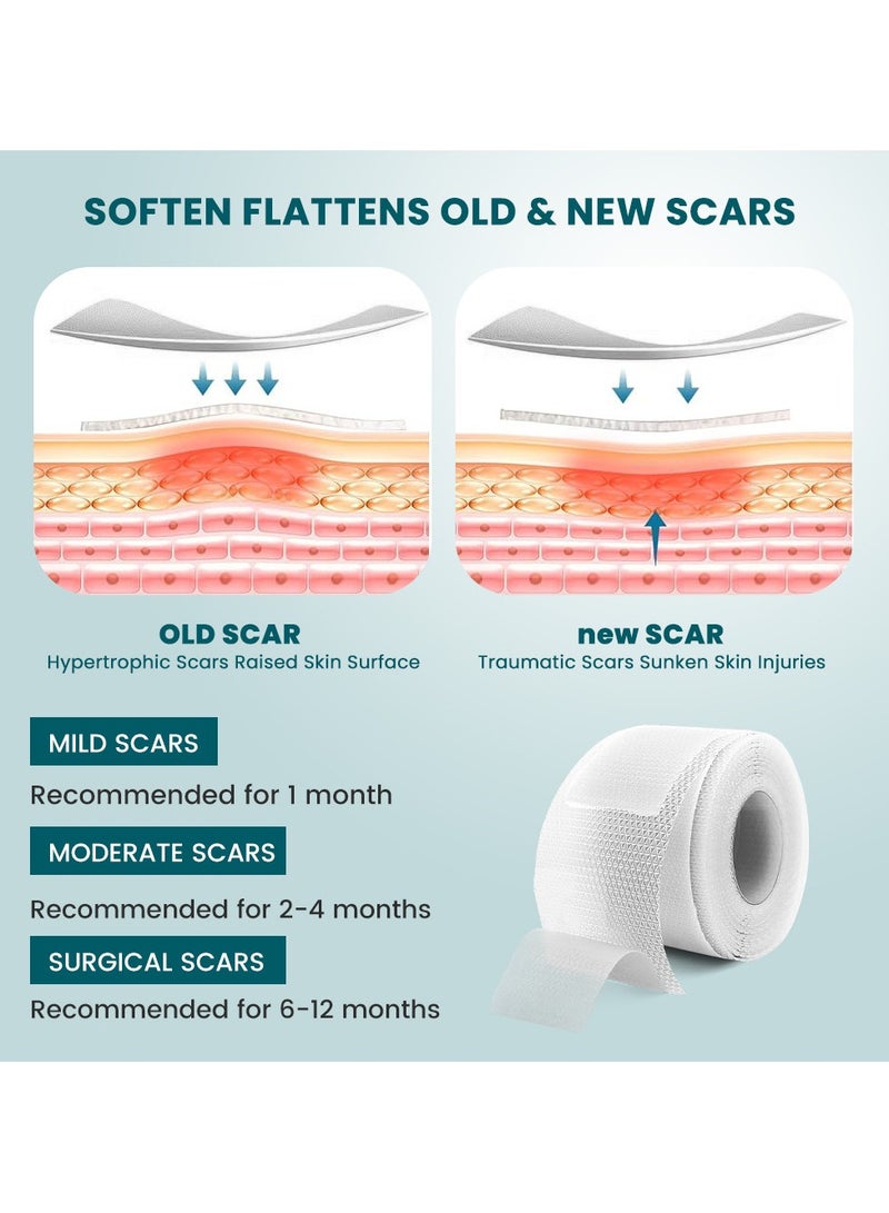 سوميفون رقعة إصلاح الجروح والندبات، رقعة إزالة الندبات الجراحية، رقعة العناية بندبات الصدمات الرياضية (2 × 100 سم) - Image 3