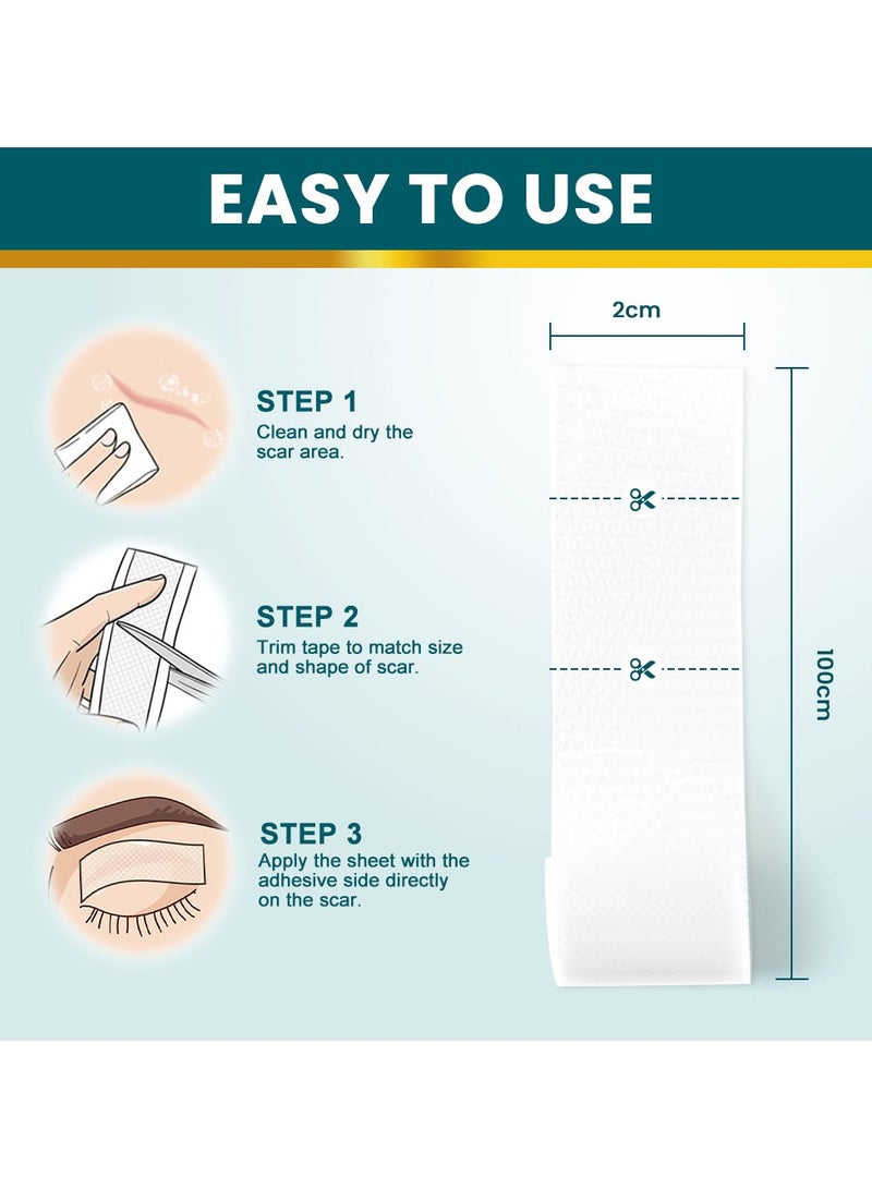 سوميفون رقعة إصلاح الجروح والندبات، رقعة إزالة الندبات الجراحية، رقعة العناية بندبات الصدمات الرياضية (2 × 100 سم) - Image 5