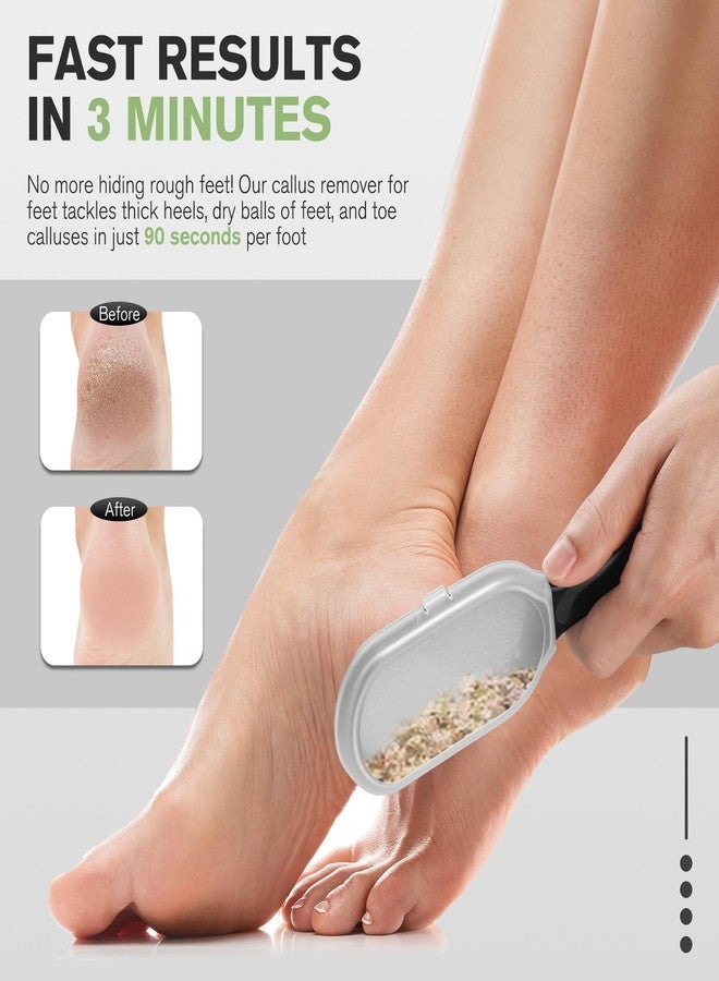 FERYES Foot File Callus Remover with Dead Skin Catcher – The Genius Foot Scrubber for Mess-Free Pedicures, Heel Scraper for Cracked Heel Treatment, Wet & Dry Use Feet Rasp - Black - Image 2