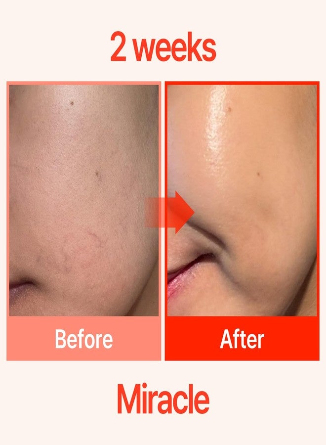 COSNORI PDRN-Shot 675 - Korea Facial Serum with 675,000 high purity spicules - Turnover K-Beauty Face Serum with High Nutrition Salmon DNA PDRN - Intensive facial first essence (50ml / 1.69 fl. oz.) - Image 3