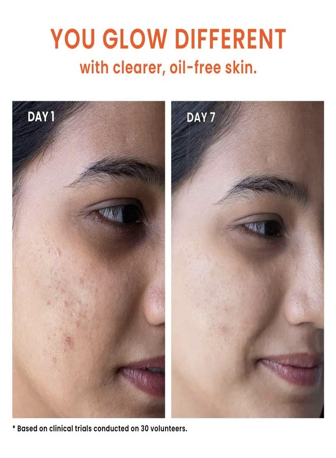 Foxtale Oil and Acne Control Face Wash | 2% Salicylic Acid + Niacinamide + Cica + Hyaluronic Acid | Fights Acne, Fades Marks, Controls Oil, Soothes Skin | Non-Drying Cleanser for Oily Skin - Image 5