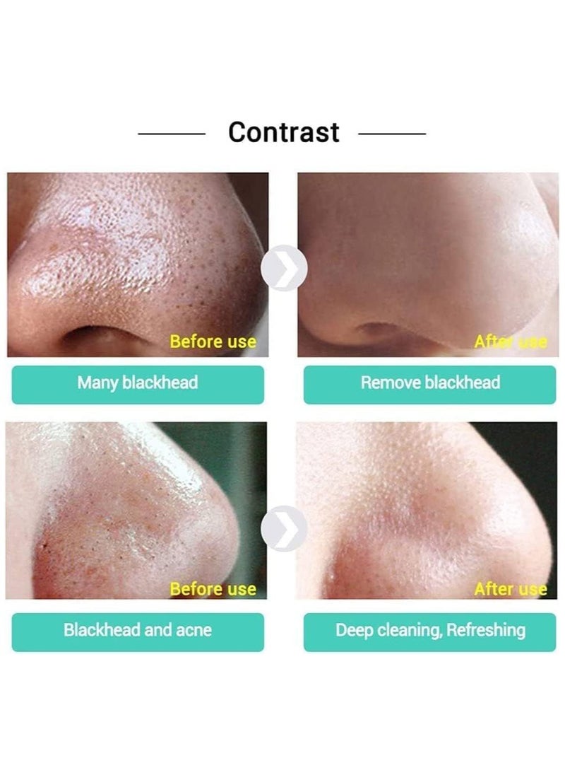 BP - Aloe Vera Blackhead Remover For Blackheads Acne Treatment Natural Beauty Products 30G, 1 Count - Image 1