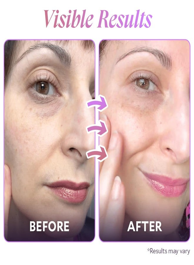 FIÈRA Bakuchiol Firming Eye Cream - Designed Specifically For Mature Skin - Targets Wrinkles, Anti-Aging, Dark Spots, and Fine Lines - Hydrating and Rejuvenating Formula - 15 ML / 0.5 FL. OZ. - Image 5